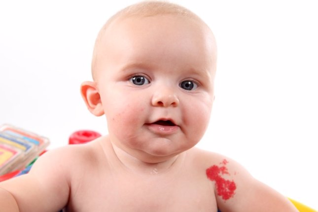 Angiomas en la piel del bebé