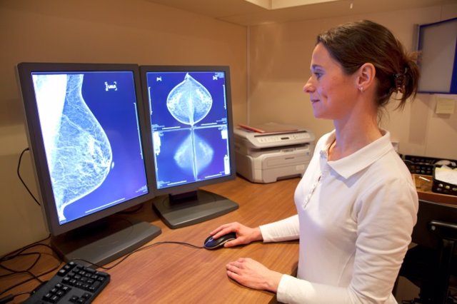 Resonancia magnética  de mama